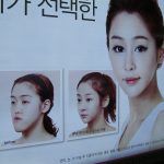plastic surgery South Korea